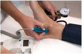 Medición del índice tobillo-brazo con doppler portátil para valorar el estado arterial antes de comprimir una úlcera venosa